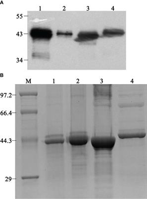 Screening of linear B-cell epitopes and its proinflammatory activities of Haemophilus parasuis outer membrane protein P2